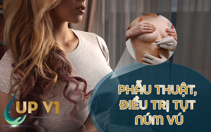 phẫu thuật điều trị tụt núm vú 