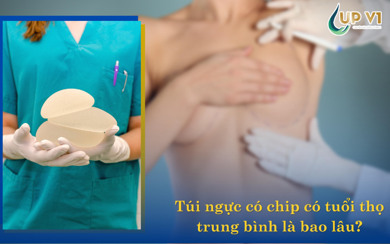 tuổi thọ túi ngực gắn chip