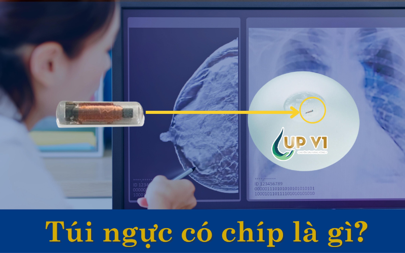 túi ngực chứa chip