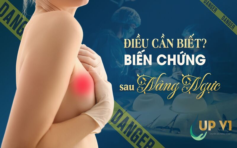 hậu quả nâng vòng 1 