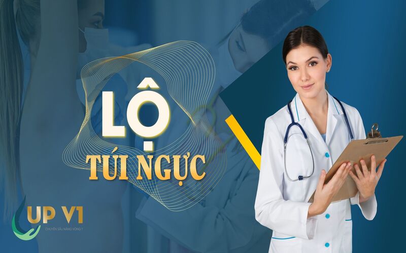 tình trạng lộ túi nâng ngực