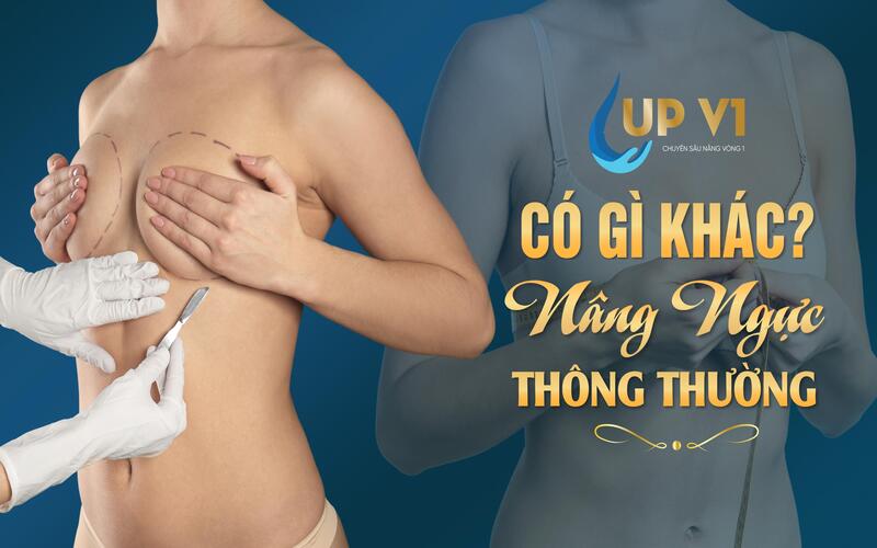 Phẫu thuật nâng ngực và nâng ngực sa trễ