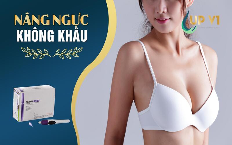 kỹ thuật nâng ngực không dùng mũi khâu