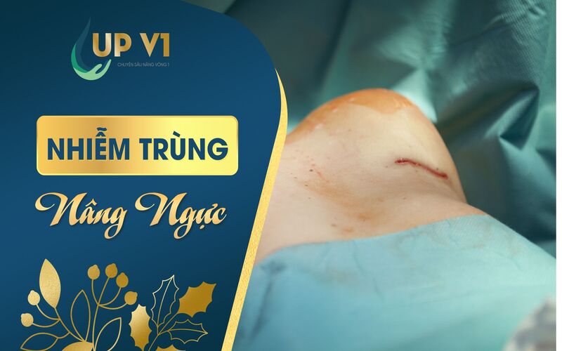 nâng ngực bị nhiễm trùng