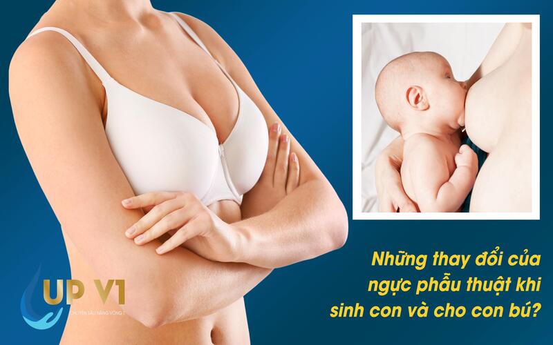 nâng ngực và những điều cần biết