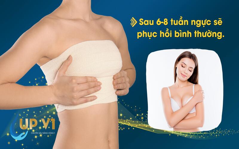 thay đổi sau khi nâng ngực: Ngực mềm