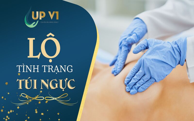 Lộ túi trong khoảng thời gian sau