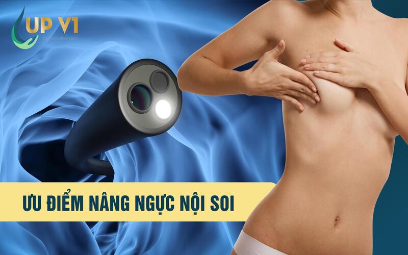 ưu điểm nâng ngực nội soi