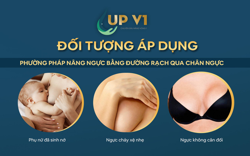 đối tượng nâng ngực qua đường chân ngực