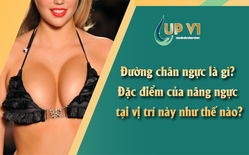 nâng ngực bằng đường chân ngực là gì