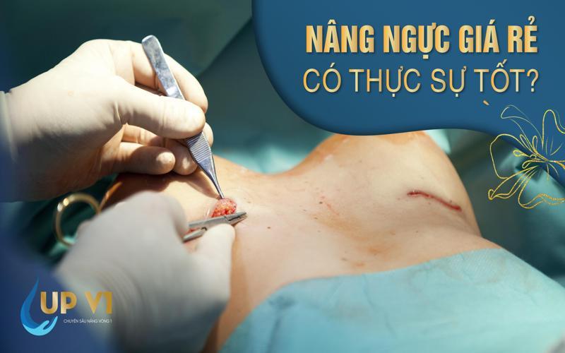 Nâng ngực giá rẻ tốt hay không?