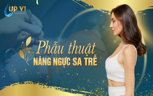 Phẫu thuật ngực sa trễ