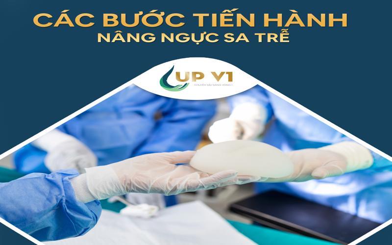 Các bước tiến hành nâng ngực sa trễ