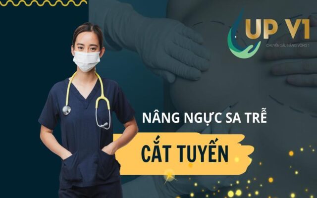 nâng ngực sa trễ cắt tuyến