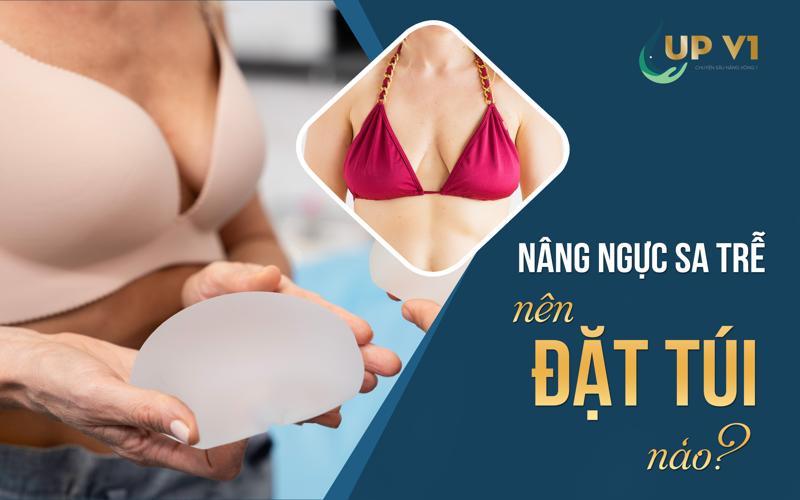 nâng ngực sa trễ đặt túi nào