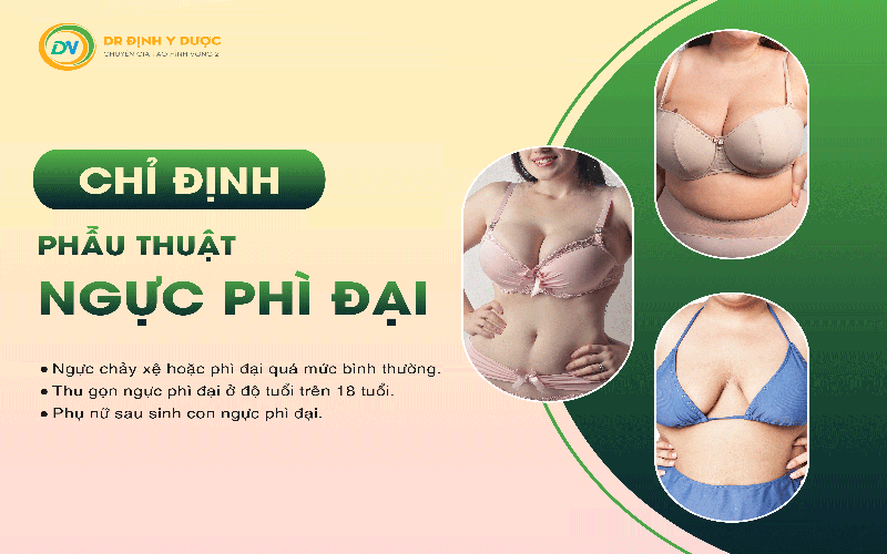 Chỉ định phẫu thuật ngực phì đại