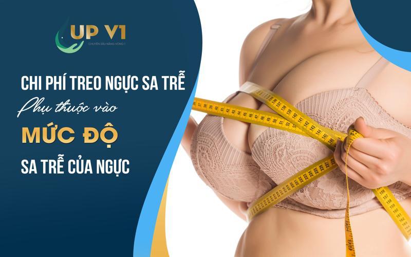 Chi phí treo ngực sa trễ