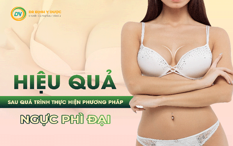 phẫu thuật ngực phì đại có hiệu quả không