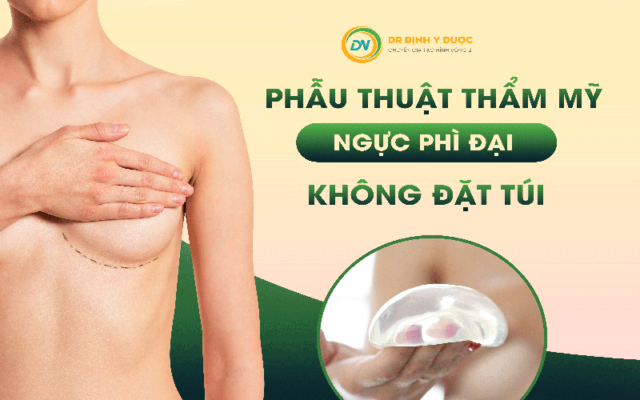 phẫu thuật ngực phì đại không đặt túi