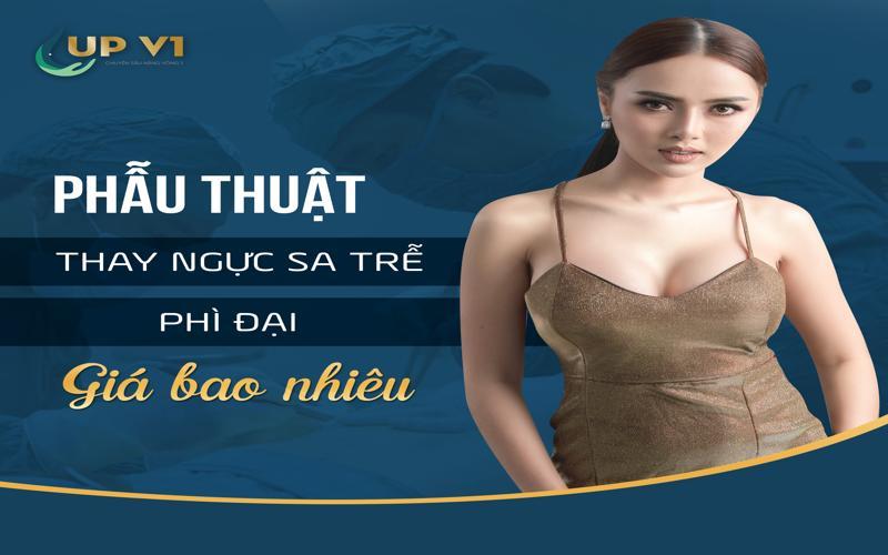 chi phí nâng ngực sa trễ