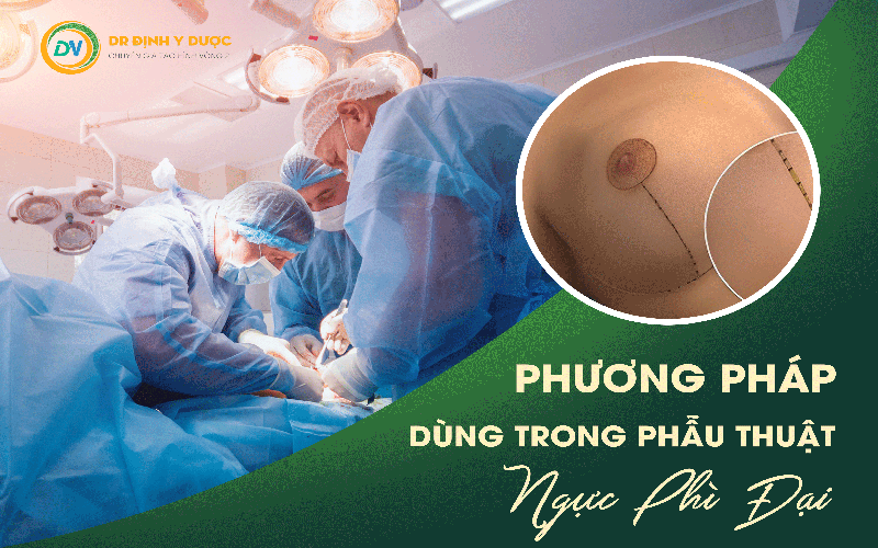 Phương pháp phẫu thuật ngực phì đại