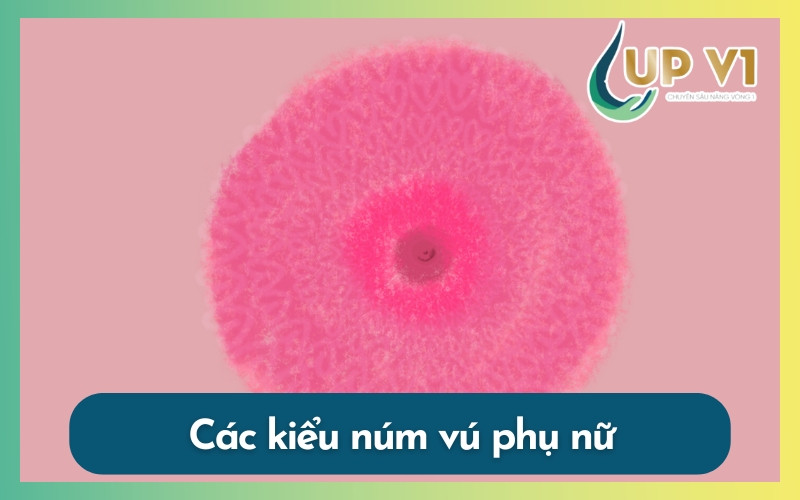 các kiểu nhũ hoa