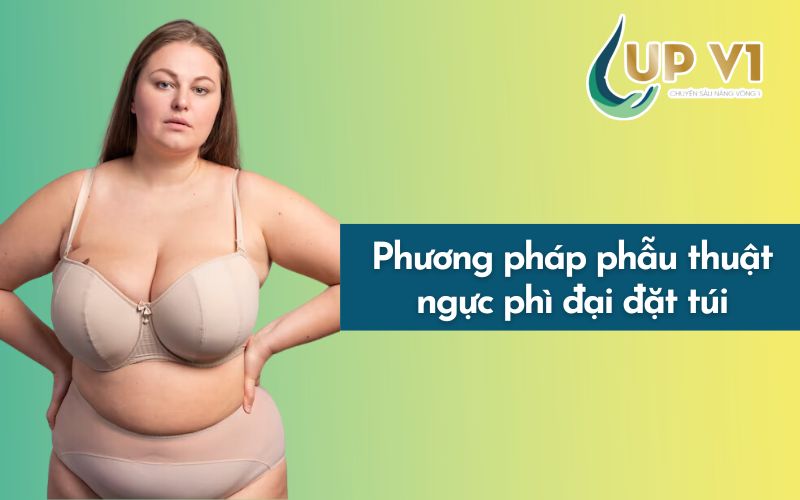 phẫu thuật ngực phì đại đặt túi