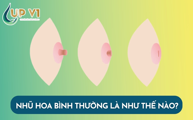 nhũ hoa bình thường