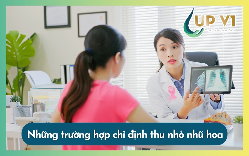 chỉ định thu nhỏ quầng nhũ hoa