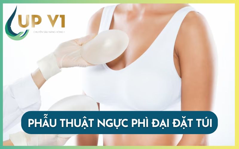 phẫu thuật ngực phì đại đặt túi