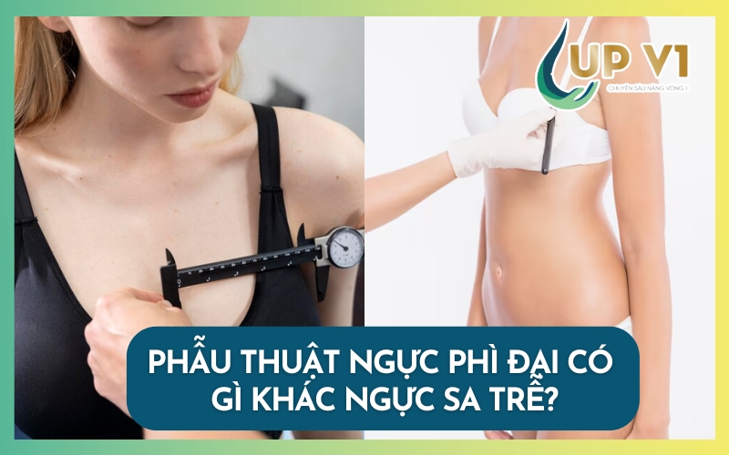 phẫu thuật ngực phì đại và ngực sa trễ