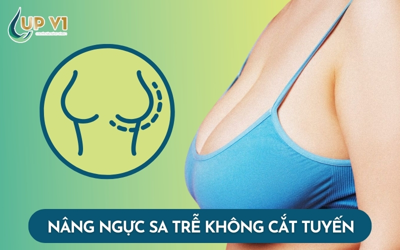 Nâng Ngực Sa Trễ Không Cắt Tuyến